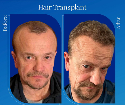 Slider image (4) Odin Clinic